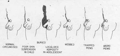 ce penis normal