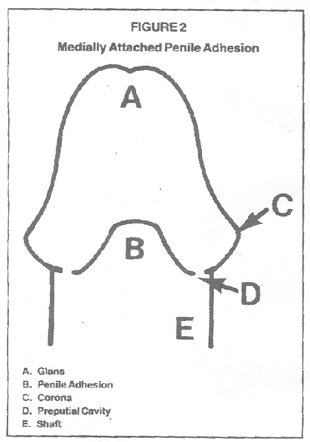 Shaft Of Penis