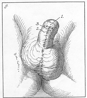 Figure 1 g