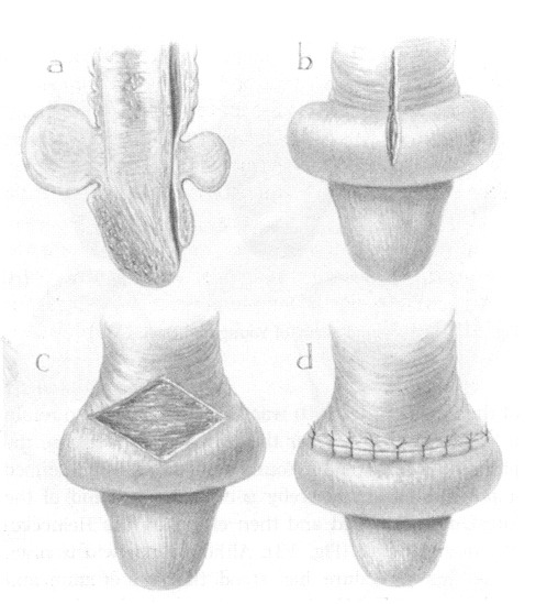 Figure 14